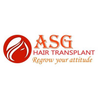 Hair Transplant in Ludhiana - ASG Hair Transplant Centre